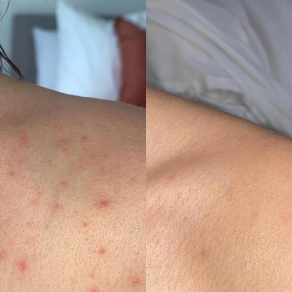 <p><strong>Des milliers de clients ont retrouvé une peau sans tâches et plus lisse</strong></p>