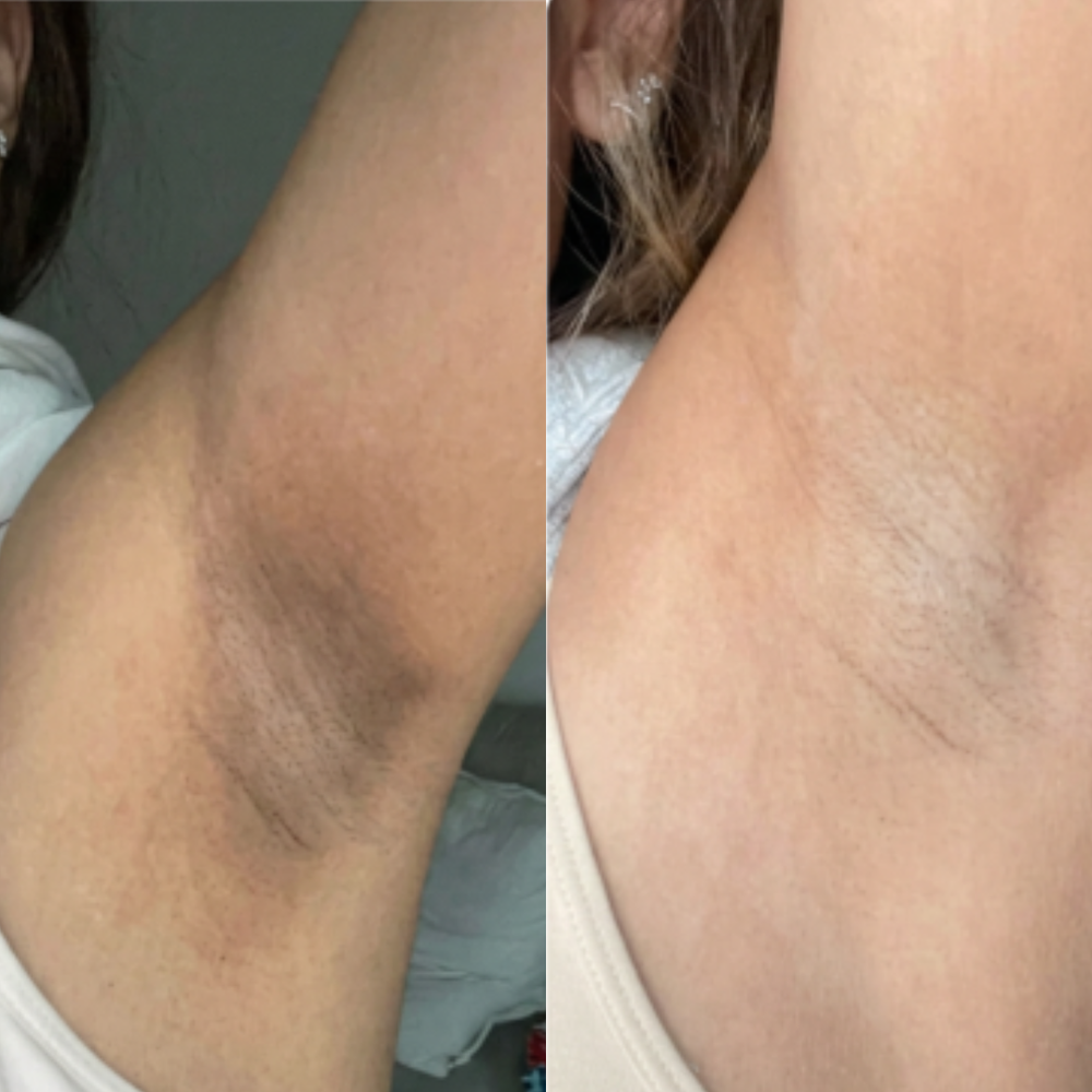 <p><strong>Des milliers de clients ont retrouvé une peau sans tâches et plus lisse</strong></p>
