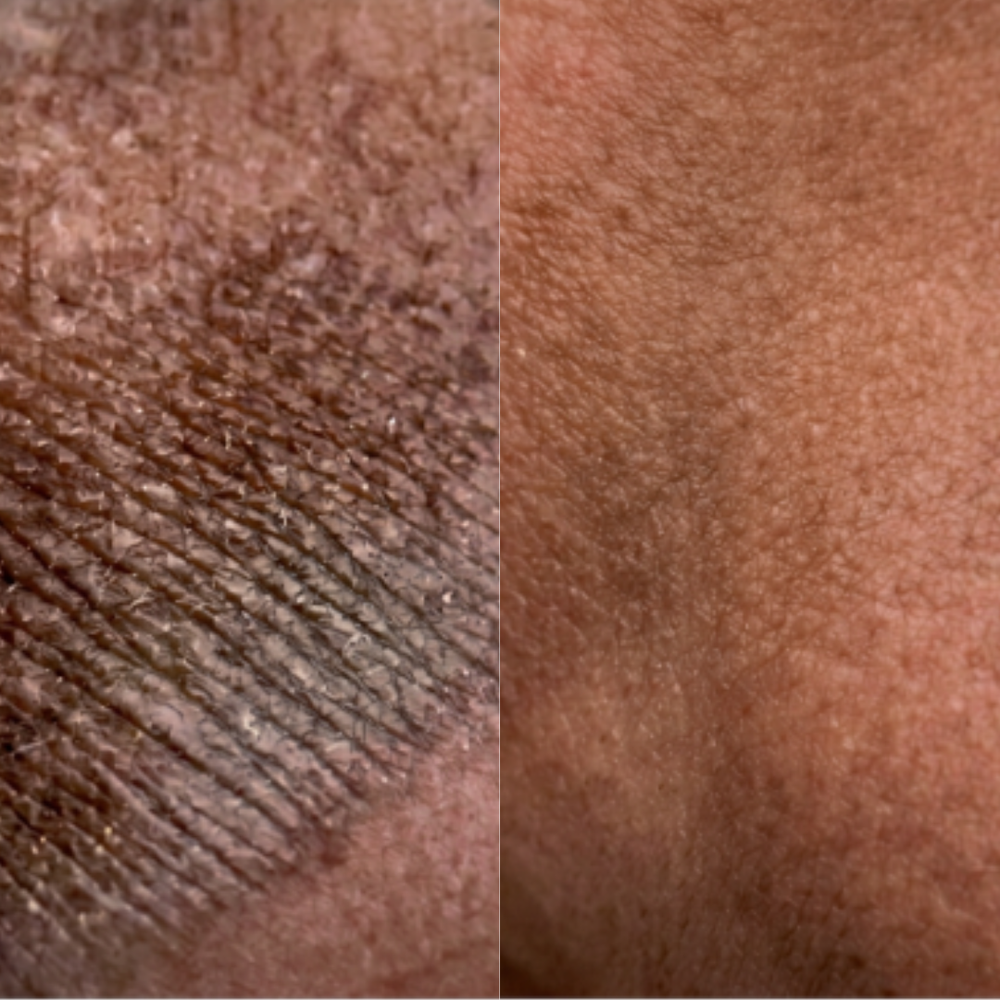 <p><strong>Des milliers de clients ont retrouvé une peau sans tâches et plus lisse</strong></p>